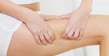 Como diminuir a celulite das pernas