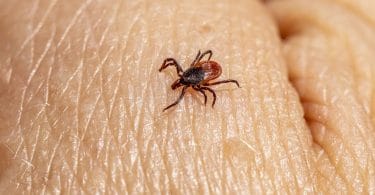 Sonhar com Carrapato: Sonhar com carrapato pode revelar mensagens importantes sobre sua vida e suas relações interpessoais.